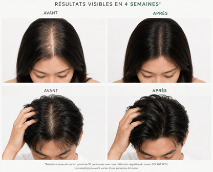 SOLANE N°01 – Shampoing Solide Anti-Chute | Cheveux Plus Forts & Plus Denses